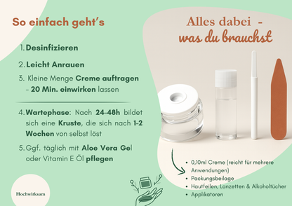 Creamole - 100% natürliche Creme zur Entfernung von Muttermalen, Leberflecken & Warzen